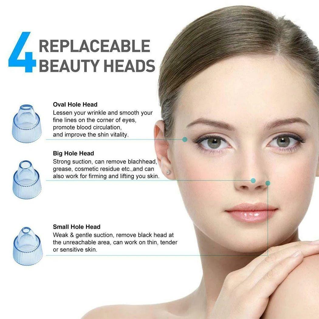 Cell Operated 4-in-1 Vacuum Blackhead Remover Machine